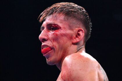 Jafai's problem after Rodriguez's victory and drug test results