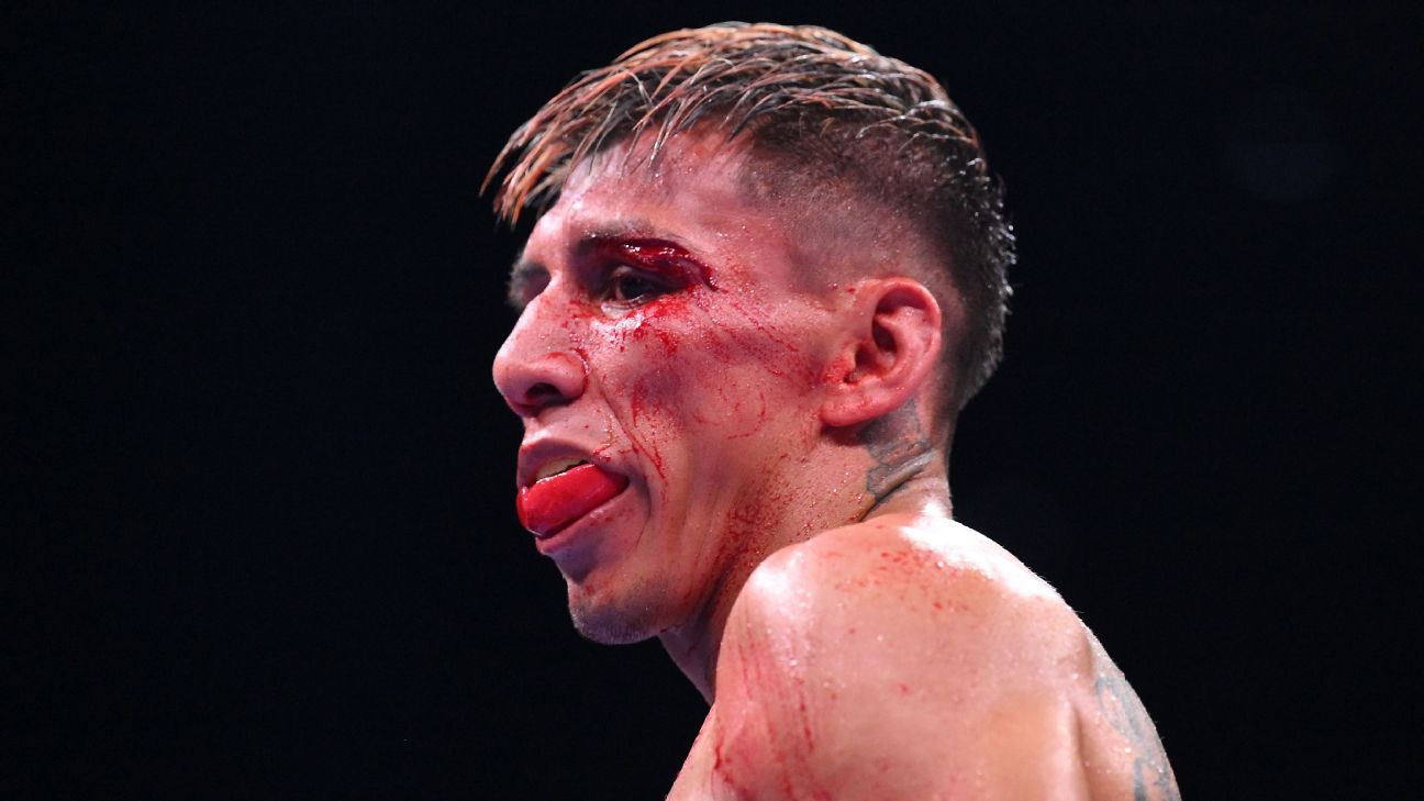 Jafai's problem after Rodriguez's victory and drug test results
