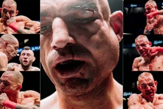 Ste Wallwork's dream turns nightmare for his face at BKFC 94