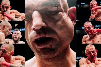 Ste Wallwork's dream turns nightmare for his face at BKFC 94