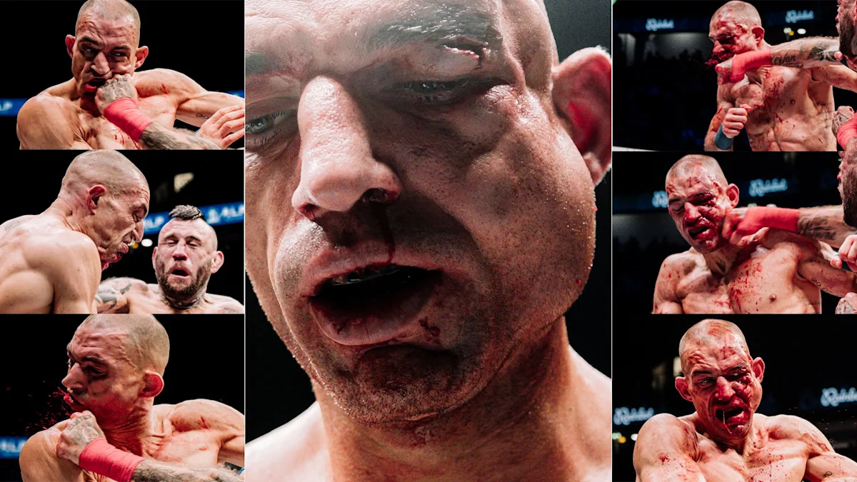 Ste Wallwork's dream turns nightmare for his face at BKFC 94
