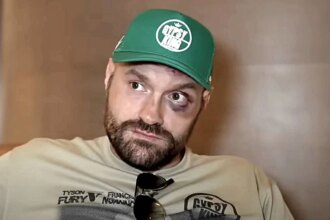 Tyson Fury blames Eddie Hearn for blocking biggest fight in British boxing history