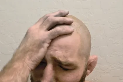 UFC champ Sean Strickland says he 'rolled like six times' in motor vehicle accident